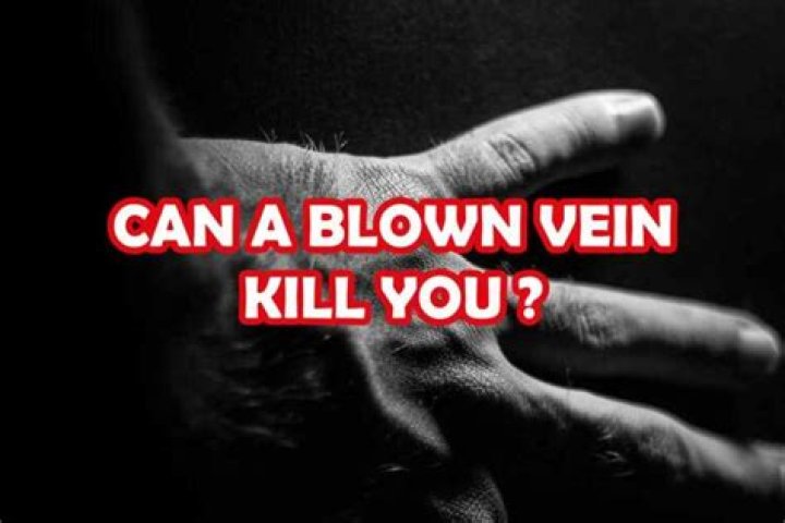 can a blown vein kill you