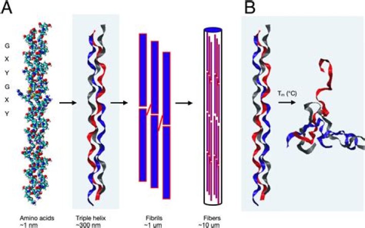 the cartilage type with a great deal of collagen in the matrix