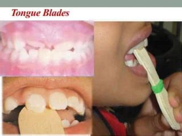 what is a padded tongue blade used for